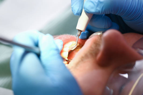 Best Broken or Chipped Tooth Repair in Thomasville, NC