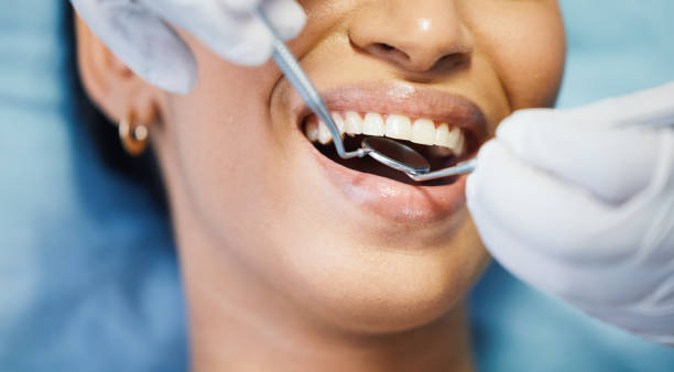 Best Emergency Denture Repair in Thomasville, NC